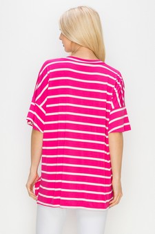 Women’s Striped Oversized Short Sleeve Top style 3